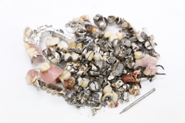 歯科金属屑・歯科スクラップ金属(撤去冠・除去冠)