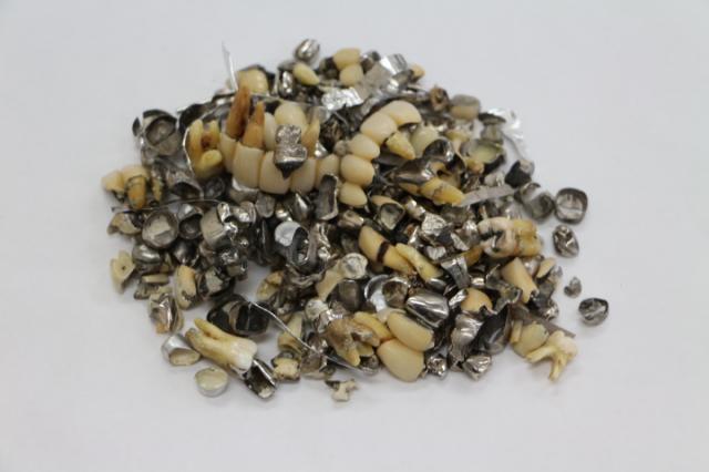 歯科金属屑・歯科スクラップ金属(撤去冠・除去冠)