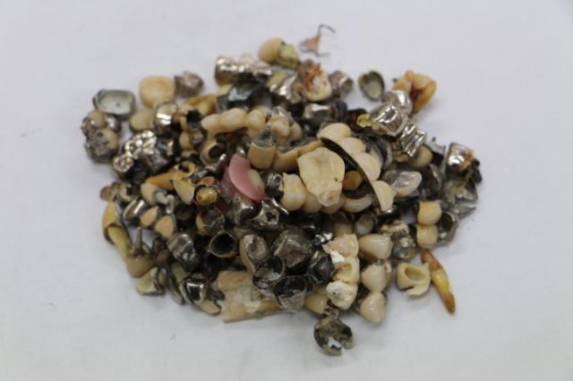 歯科金属屑・歯科スクラップ金属(撤去冠・除去冠)