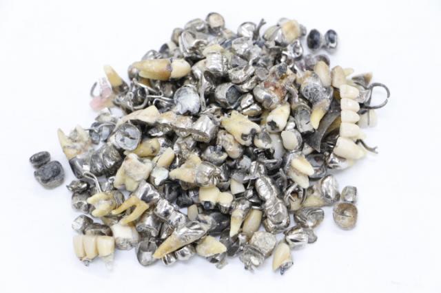 歯科金属屑・歯科スクラップ金属(撤去冠・除去冠)