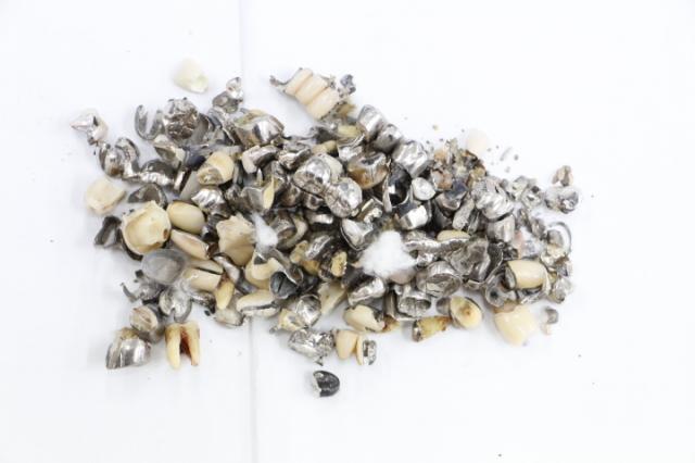 歯科金属屑・歯科スクラップ金属(撤去冠・除去冠)