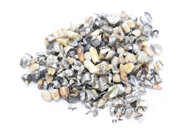 歯科金属屑・歯科スクラップ金属(撤去冠・除去冠)