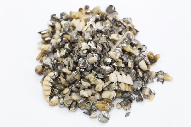 歯科金属屑・歯科スクラップ金属(撤去冠・除去冠)