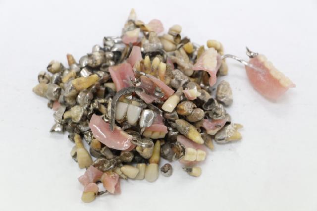 歯科金属屑・歯科スクラップ金属(撤去冠・除去冠)